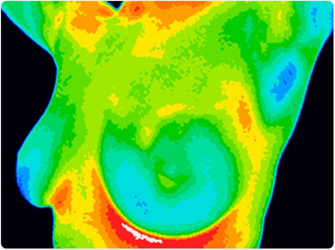 Radiation from a mammogram