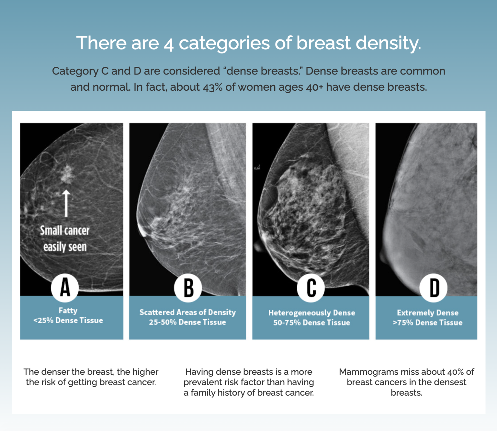 New Homepage Template Dense Breasts Canada